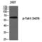 Mitogen-Activated Protein Kinase Kinase Kinase 7 antibody, PA5-40269, Invitrogen Antibodies, Western Blot image 
