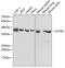 Actin Related Protein 2 antibody, GTX30022, GeneTex, Western Blot image 