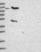 ATP Binding Cassette Subfamily B Member 8 antibody, NBP1-91643, Novus Biologicals, Western Blot image 