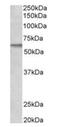 Serine/threonine-protein kinase receptor R3 antibody, orb18643, Biorbyt, Western Blot image 