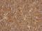Actin Related Protein T1 antibody, NBP2-15278, Novus Biologicals, Immunohistochemistry paraffin image 