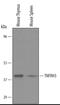 Tumor necrosis factor receptor superfamily member 26 antibody, AF5330, R&D Systems, Western Blot image 