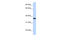 Lipocalin 12 antibody, 27-176, ProSci, Enzyme Linked Immunosorbent Assay image 