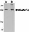 Secretory Carrier Membrane Protein 4 antibody, orb94297, Biorbyt, Western Blot image 