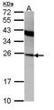 Interferon Alpha 2 antibody, GTX108284, GeneTex, Western Blot image 