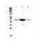 Serpin Family E Member 1 antibody, A00637-2, Boster Biological Technology, Western Blot image 
