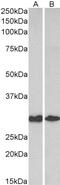 Nicotinamide N-Methyltransferase antibody, 43-640, ProSci, Western Blot image 