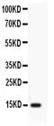 Profilin 2 antibody, PA5-79812, Invitrogen Antibodies, Western Blot image 