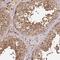 Tetratricopeptide Repeat Domain 12 antibody, NBP1-83693, Novus Biologicals, Immunohistochemistry paraffin image 