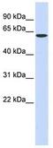 Serine Palmitoyltransferase Long Chain Base Subunit 1 antibody, ab84585, Abcam, Western Blot image 