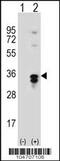 Palmitoyl-Protein Thioesterase 1 antibody, 61-421, ProSci, Western Blot image 