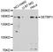 SET Binding Protein 1 antibody, A01971, Boster Biological Technology, Western Blot image 
