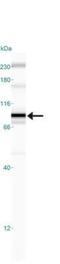Inhibitor Of Nuclear Factor Kappa B Kinase Subunit Beta antibody, GTX12139, GeneTex, Western Blot image 