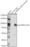 Ribosomal Protein S6 Kinase A1 antibody, GTX66605, GeneTex, Immunoprecipitation image 
