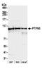 Protein Tyrosine Phosphatase Non-Receptor Type 3 antibody, NBP2-78797, Novus Biologicals, Western Blot image 