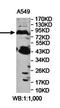 Patatin Like Phospholipase Domain Containing 8 antibody, orb78412, Biorbyt, Western Blot image 
