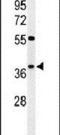 Kelch Domain Containing 2 antibody, PA5-24748, Invitrogen Antibodies, Western Blot image 