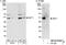 SET Domain Containing 7, Histone Lysine Methyltransferase antibody, NB100-93288, Novus Biologicals, Western Blot image 