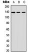 Inositol Polyphosphate Phosphatase Like 1 antibody, MBS8224922, MyBioSource, Western Blot image 