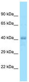 Zinc finger protein 73 antibody, TA339230, Origene, Western Blot image 