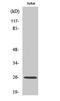 Complement C1q B Chain antibody, A04233-1, Boster Biological Technology, Western Blot image 