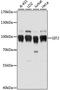 ARF GTPase-activating protein GIT2 antibody, A15368, ABclonal Technology, Western Blot image 