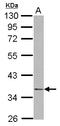 Nuclear distribution protein nudE homolog 1 antibody, LS-C155535, Lifespan Biosciences, Western Blot image 