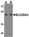 Solute Carrier Family 29 Member 3 antibody, A04749, Boster Biological Technology, Western Blot image 
