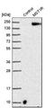 Macrophage Stimulating 1 Receptor antibody, NBP1-88137, Novus Biologicals, Western Blot image 