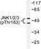 Mitogen-Activated Protein Kinase 8 antibody, LS-C177979, Lifespan Biosciences, Western Blot image 