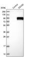 DExD-Box Helicase 50 antibody, NBP1-83311, Novus Biologicals, Western Blot image 