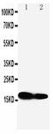 Interferon Induced Transmembrane Protein 1 antibody, PA1112, Boster Biological Technology, Western Blot image 