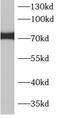 Adaptor Protein, Phosphotyrosine Interacting With PH Domain And Leucine Zipper 2 antibody, FNab00517, FineTest, Western Blot image 