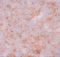 Transmembrane Protein 38B antibody, 5523, ProSci, Immunohistochemistry paraffin image 