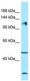 Integrin Subunit Alpha 2 antibody, TA338255, Origene, Western Blot image 