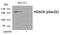 Histone Deacetylase 6 antibody, GTX55403, GeneTex, Western Blot image 