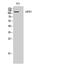 Lemur Tyrosine Kinase 3 antibody, A08432-1, Boster Biological Technology, Western Blot image 