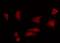 Rho GTPase Activating Protein 35 antibody, GTX52344, GeneTex, Immunocytochemistry image 