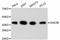 Glycogen Synthase Kinase 3 Beta antibody, STJ112773, St John