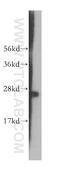 Aspartate Beta-Hydroxylase antibody, 14116-1-AP, Proteintech Group, Western Blot image 