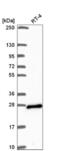 ADP Ribosylation Factor Like GTPase 15 antibody, NBP2-56877, Novus Biologicals, Western Blot image 