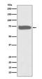 Glutamate-Cysteine Ligase Catalytic Subunit antibody, M01722, Boster Biological Technology, Western Blot image 