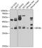Eukaryotic Translation Initiation Factor 2B Subunit Alpha antibody, GTX33172, GeneTex, Western Blot image 