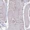 Transmembrane Protein 106C antibody, HPA047204, Atlas Antibodies, Immunohistochemistry paraffin image 