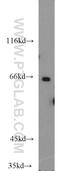 Solute Carrier Organic Anion Transporter Family Member 1C1 antibody, 17163-1-AP, Proteintech Group, Western Blot image 