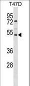SVOP Like antibody, LS-C161631, Lifespan Biosciences, Western Blot image 