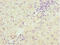 Programmed Cell Death 2 Like antibody, LS-C676228, Lifespan Biosciences, Immunohistochemistry paraffin image 