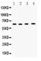 Cell Division Cycle 6 antibody, PB9531, Boster Biological Technology, Western Blot image 