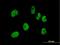 Cleavage And Polyadenylation Specific Factor 7 antibody, H00079869-B01P, Novus Biologicals, Immunocytochemistry image 