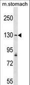 ATP/GTP Binding Protein 1 antibody, LS-C161022, Lifespan Biosciences, Western Blot image 